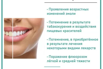 Профессиональное отбеливание зубов